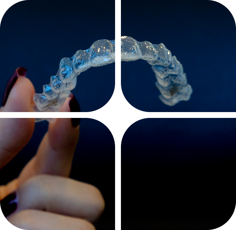 Retainers