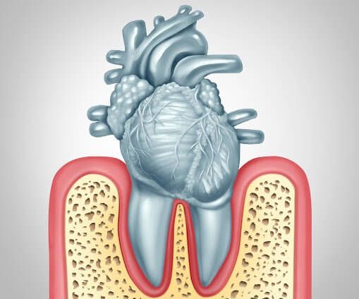 Heart disease and oral dental health