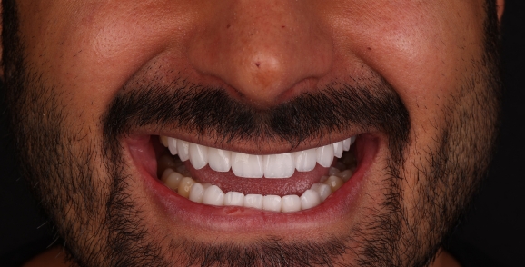 بعد