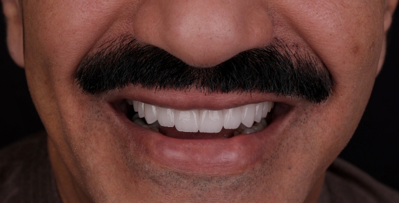 بعد
